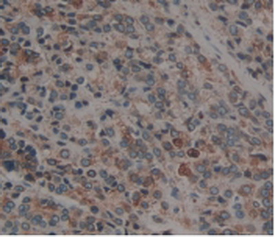 Anti-Calnexin (CNX) Polyclonal Antibody