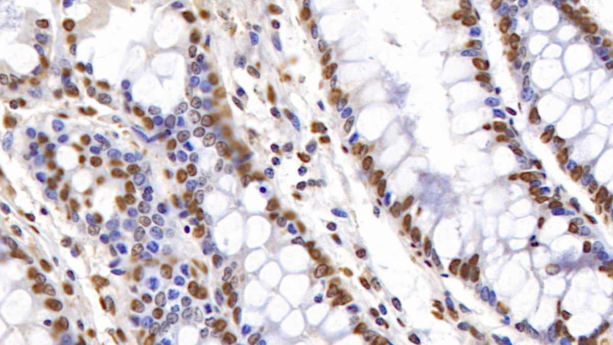 Anti-Histone H3 (H3) Polyclonal Antibody