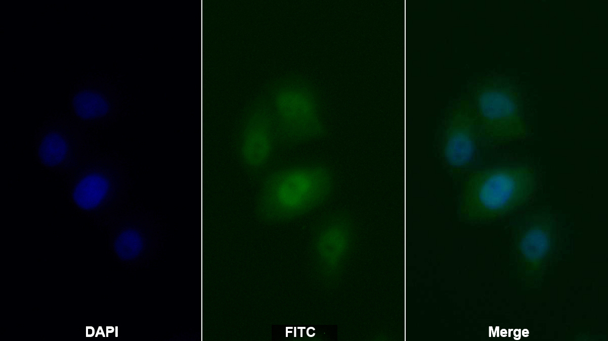 Anti-Proliferating Cell Nuclear Antigen (PCNA) Monoclonal Antibody