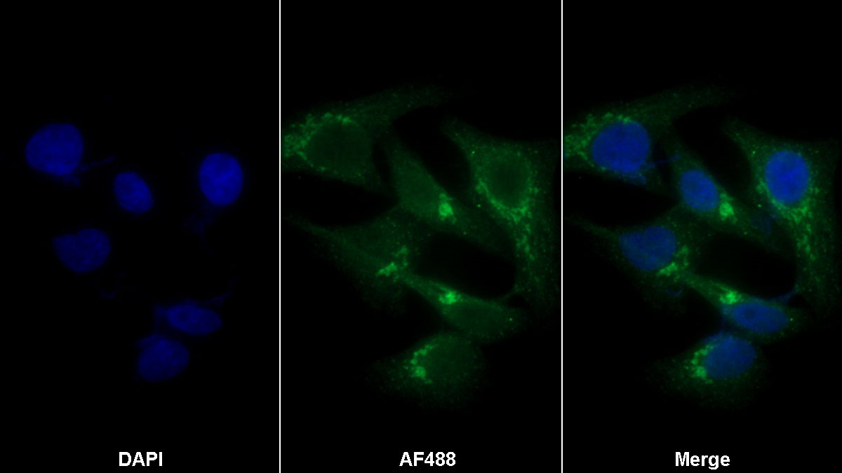 Anti-Transferrin Receptor (TFR) Polyclonal Antibody