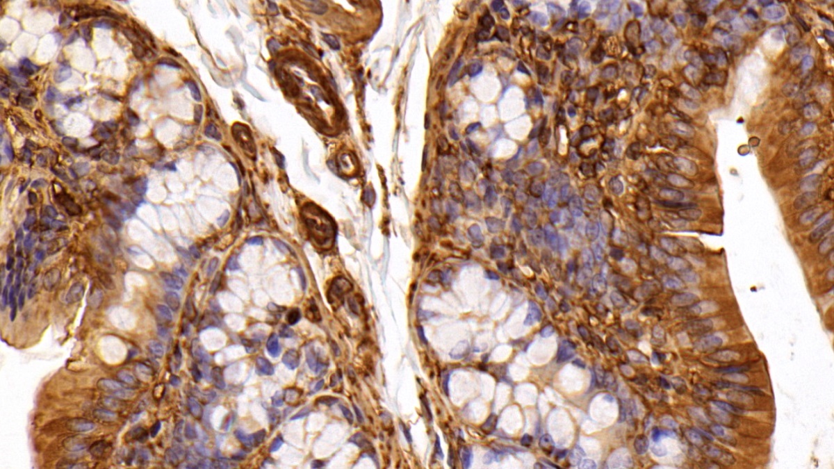 Anti-Beta Actin (ACTB) Polyclonal Antibody