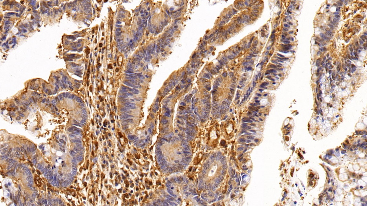 Anti-Beta Actin (ACTB) Monoclonal Antibody