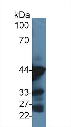 Anti-Actin Alpha 1, Cardiac Muscle (ACTC1) Monoclonal Antibody