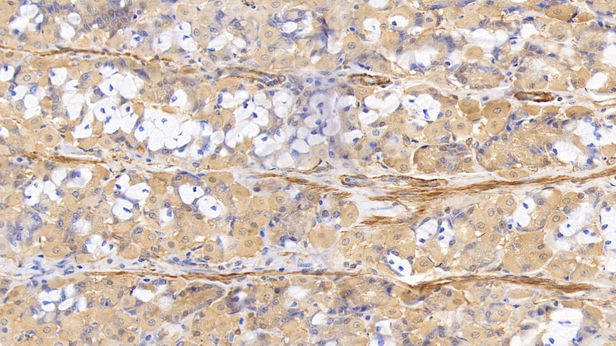 Anti-Actin Alpha 1, Cardiac Muscle (ACTC1) Monoclonal Antibody