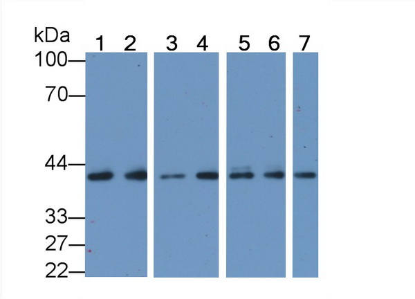 Anti-Actin Alpha 1, Cardiac Muscle (ACTC1) Monoclonal Antibody