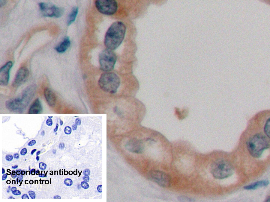 Anti-Actin Alpha 2, Smooth Muscle (ACTa2) Polyclonal Antibody