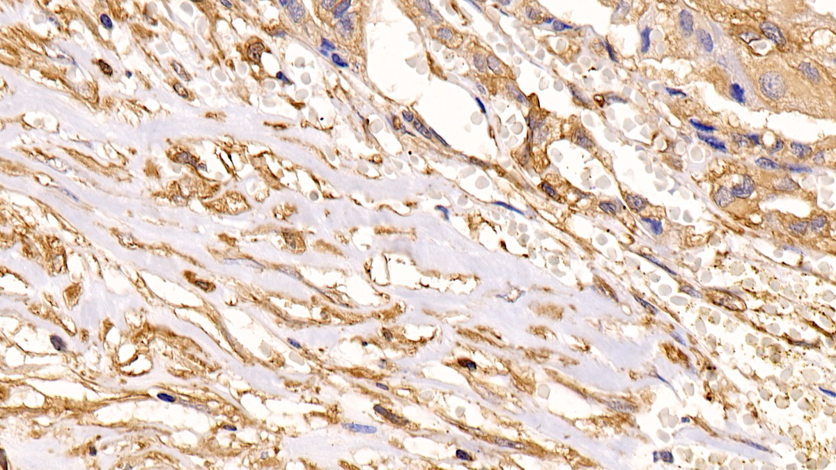 Anti-Actin Alpha 2, Smooth Muscle (ACTa2) Monoclonal Antibody