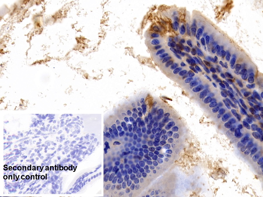 Anti-Actin Alpha 2, Smooth Muscle (ACTa2) Monoclonal Antibody