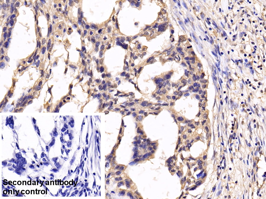 Anti-Extracellular Signal Regulated Kinase 1 (ERK1) Polyclonal Antibody