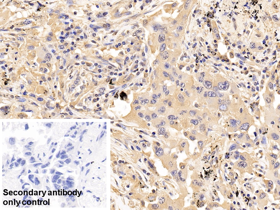 Anti-Extracellular Signal Regulated Kinase 1 (ERK1) Polyclonal Antibody