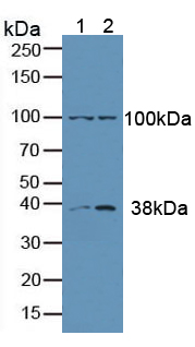 Anti-Extracellular Signal Regulated Kinase 1 (ERK1) Polyclonal Antibody