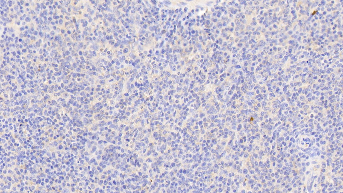 Anti-Vinculin (VCL) Polyclonal Antibody