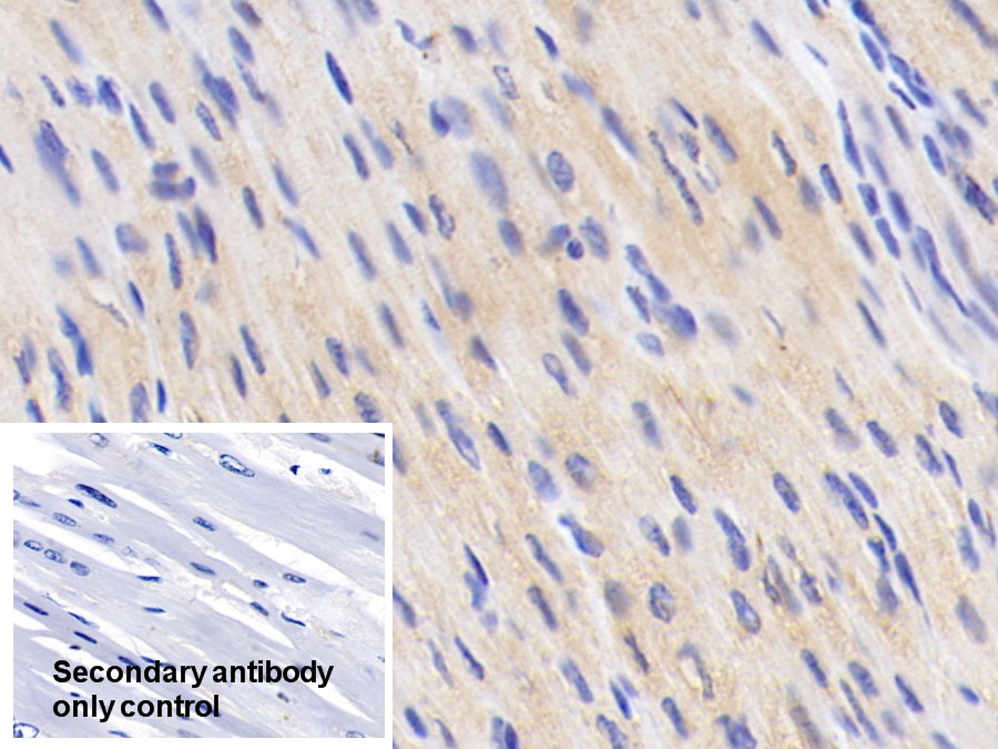 Anti-Vinculin (VCL) Polyclonal Antibody