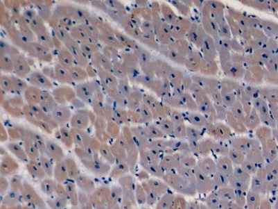 Anti-Tubulin Beta (TUBb) Monoclonal Antibody