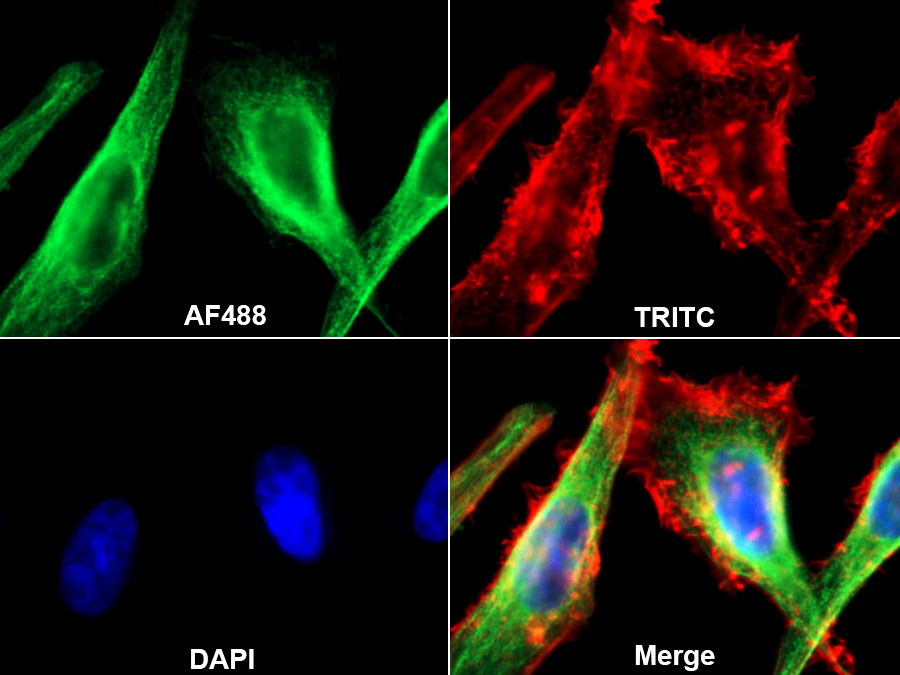 Anti-Tubulin Beta (TUBb) Monoclonal Antibody