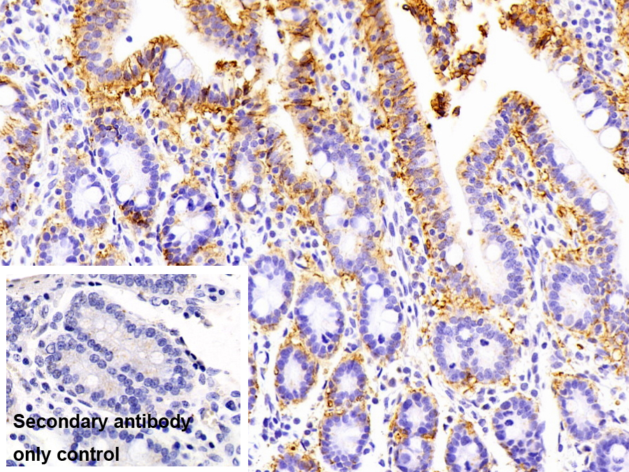 Anti-ATPase, Na+/K+ Transporting Alpha 1 Polypeptide (ATP1a1) Polyclonal Antibody