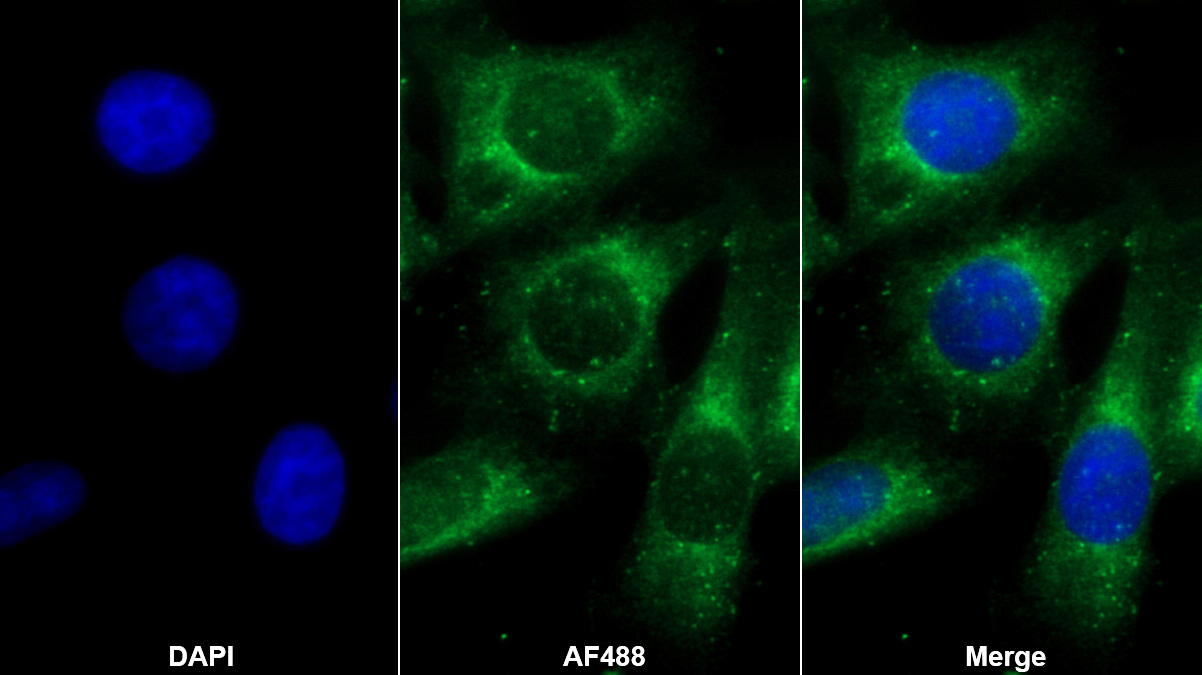 Anti-Voltage Dependent Anion Channel Protein 1 (VDAC1) Polyclonal Antibody