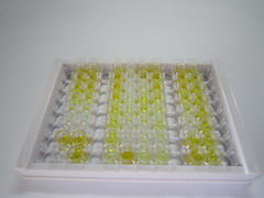 ELISA Kit for Adrenomedullin (ADM)