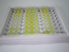 ELISA Kit for Endostatin (ES)