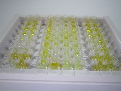 ELISA Kit for Immunoglobulin G (IgG)