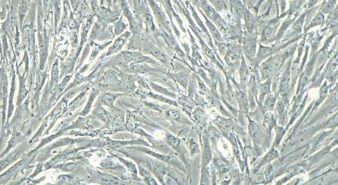 Primary Feline Cardiac Microvascular Endothelial Cells (CMEC)