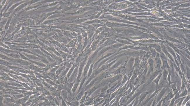 Primary Feline Cardiac Microvascular Endothelial Cells (CMEC)
