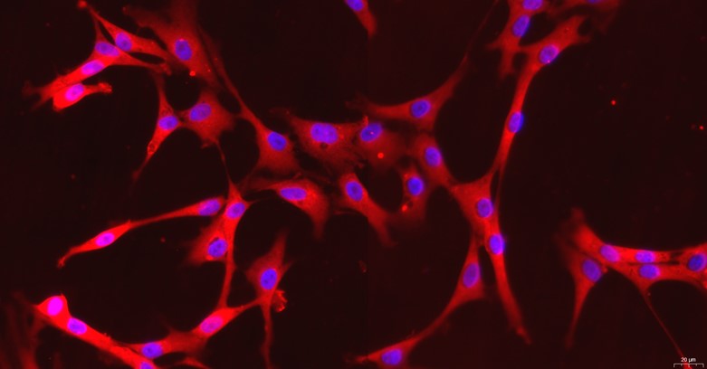 Primary Feline Cardiac Microvascular Endothelial Cells (CMEC)