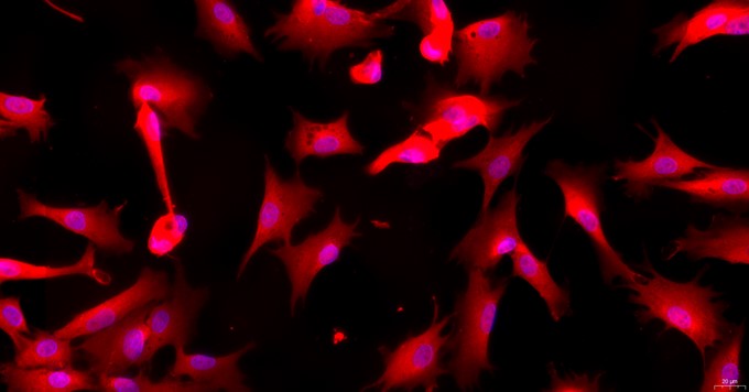 Primary Cavia Annulus Fibrosus Cells (AFC)