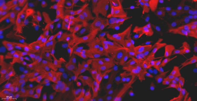 Primary Rat Brain Astrocytes (BA)