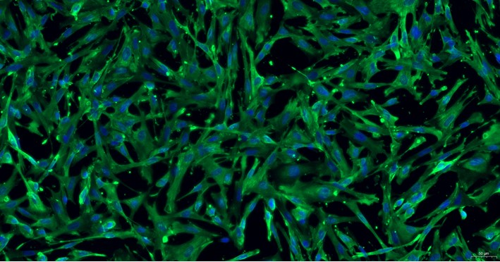 Primary Rabbit Brain Astrocytes (BA)