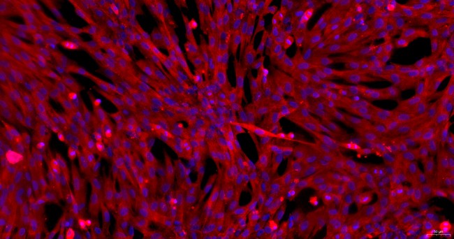 Primary Canine Brain Microvascular Endothelial Cells (BMEC)