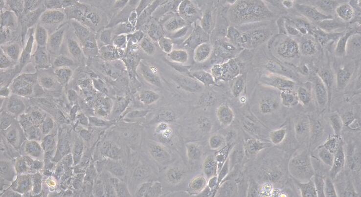Primary Rabbit Umbilical Vein Endothelial Cells (UVEC)