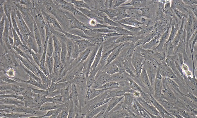 Primary Rabbit Adipose-derived Mesenchymal Stem Cells (ADSCs)
