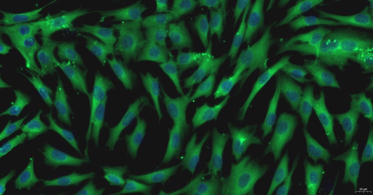 Primary Cavia Pulmonary Fibroblasts (PF)