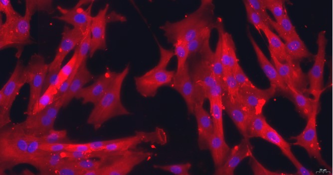 Primary Canine Uterine Smooth Muscle Cells (USMC)