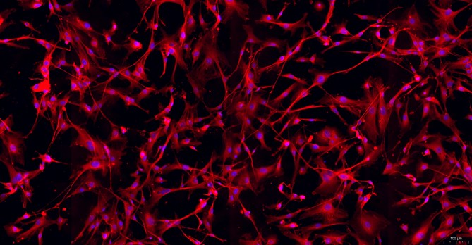 Primary Mouse Meningeal Cells (MC)