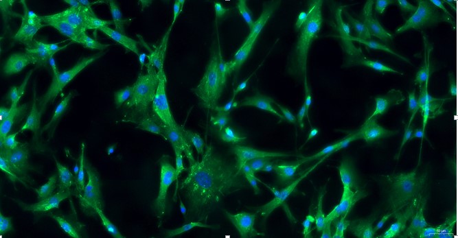 Primary Mouse Meningeal Cells (MC)
