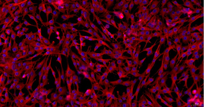 Primary Porcine Meningeal Cells (MC)