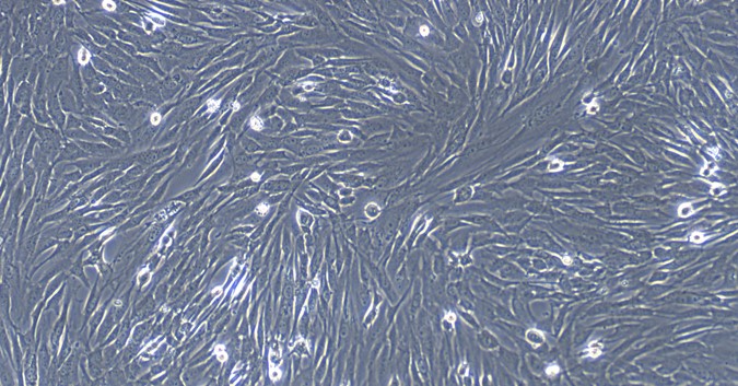 Primary Cavia Skeletal Muscle Cells (SkMC)