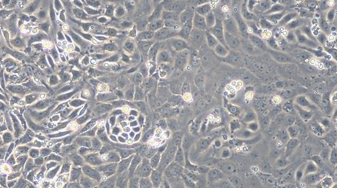 Primary Rat Renal  Tubular Epithelial Cells (RTEC)