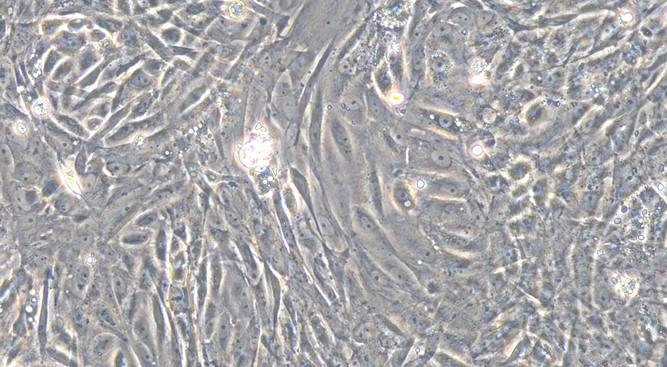 Primary Feline Renal Cortical Epithelial Cells (RCEC)