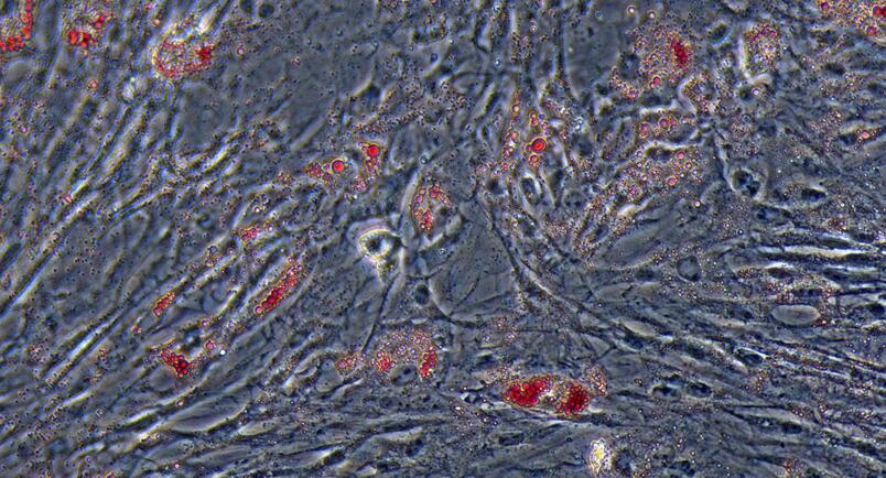 Primary Mouse Bone Marrow-derived Mesenchymal Stem Cells (BMMSCs)