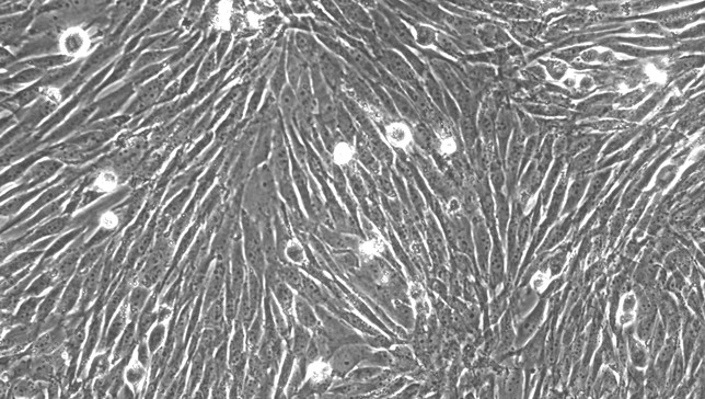 Primary Canine Periodontal Ligament Fibroblasts (PDLF)