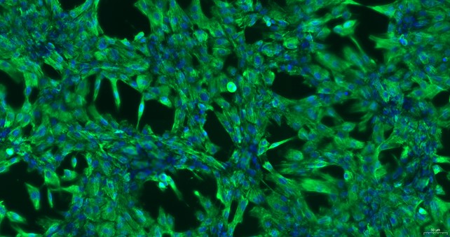 Primary Canine Periodontal Ligament Fibroblasts (PDLF)