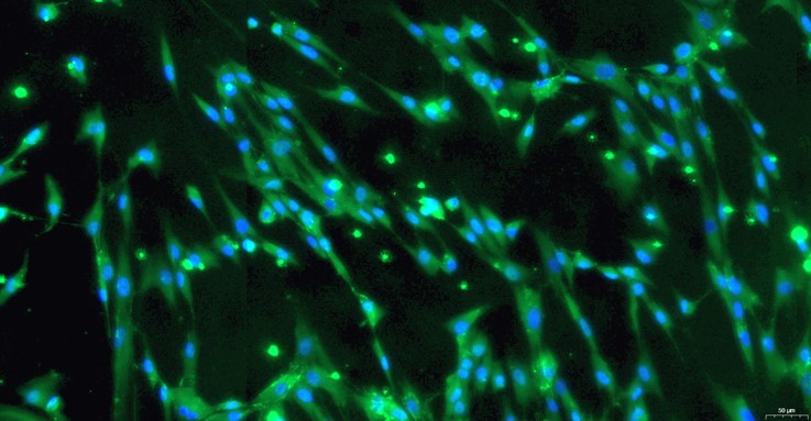 Primary Mouse Periodontal Ligament Fibroblasts (PDLF)