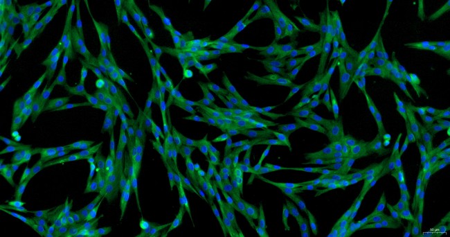 Primary Canine Adrenal Fibroblasts (ADF)