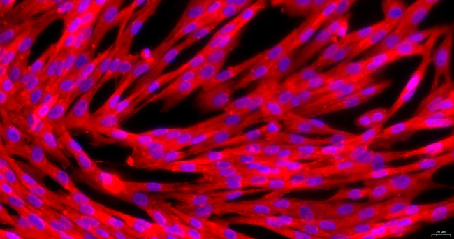 Primary Canine Adrenal Fibroblasts (ADF)