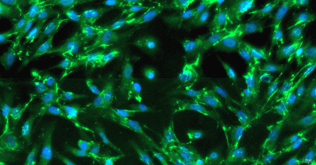 Primary Feline Splenic Fibroblasts (SF)