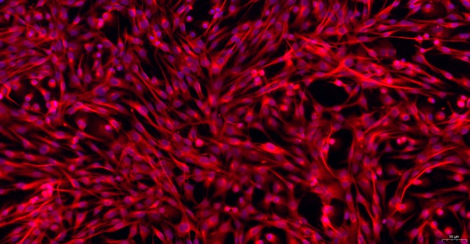 Primary Feline Splenic Fibroblasts (SF)