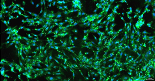 Primary Feline Splenic Fibroblasts (SF)